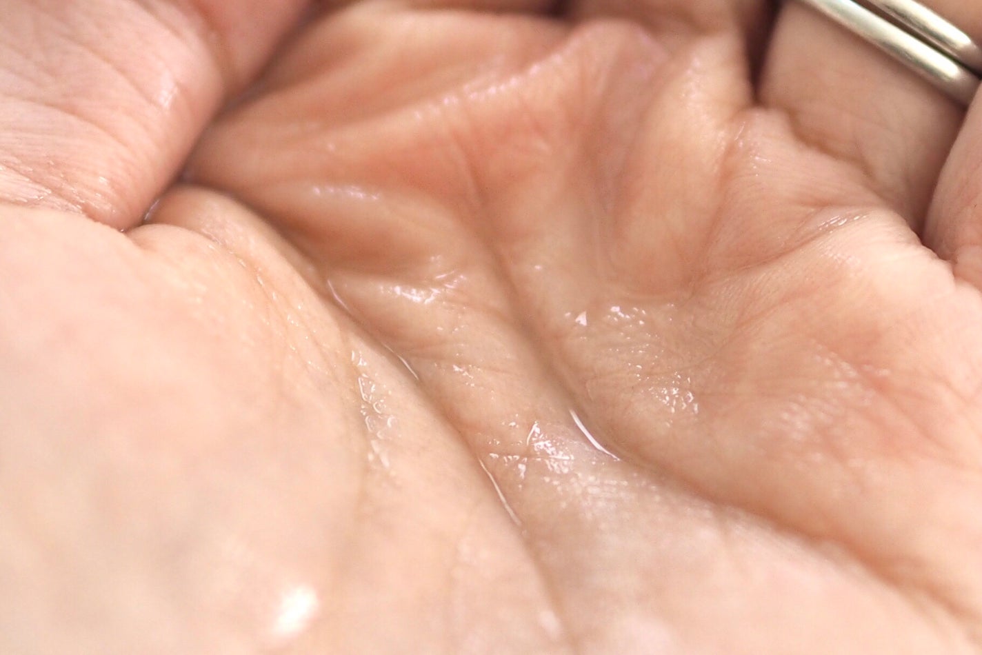 イドラクラリティ 薬用 トリートメント エッセンス ウォーター/DECORTÉ/化粧水を使ったクチコミ(5枚目)