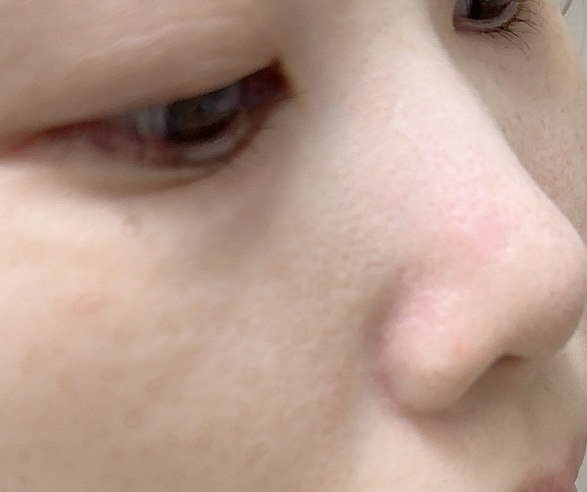 ダヴ 吸着毛穴ケア 洗顔ジェル/ダヴ/その他洗顔料を使ったクチコミ（2枚目）