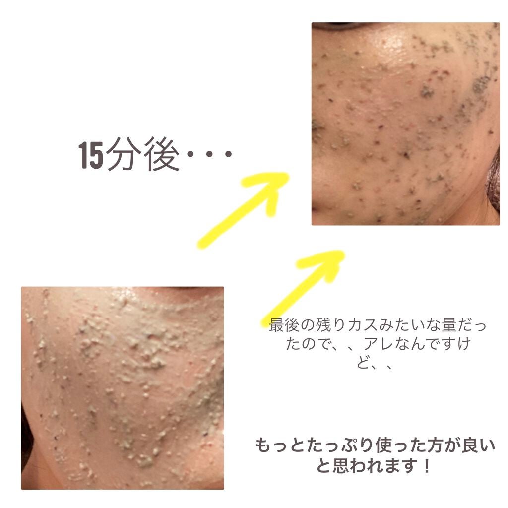 パワーマスク SP/ラッシュ/スクラブ・ゴマージュを使ったクチコミ(4枚目)