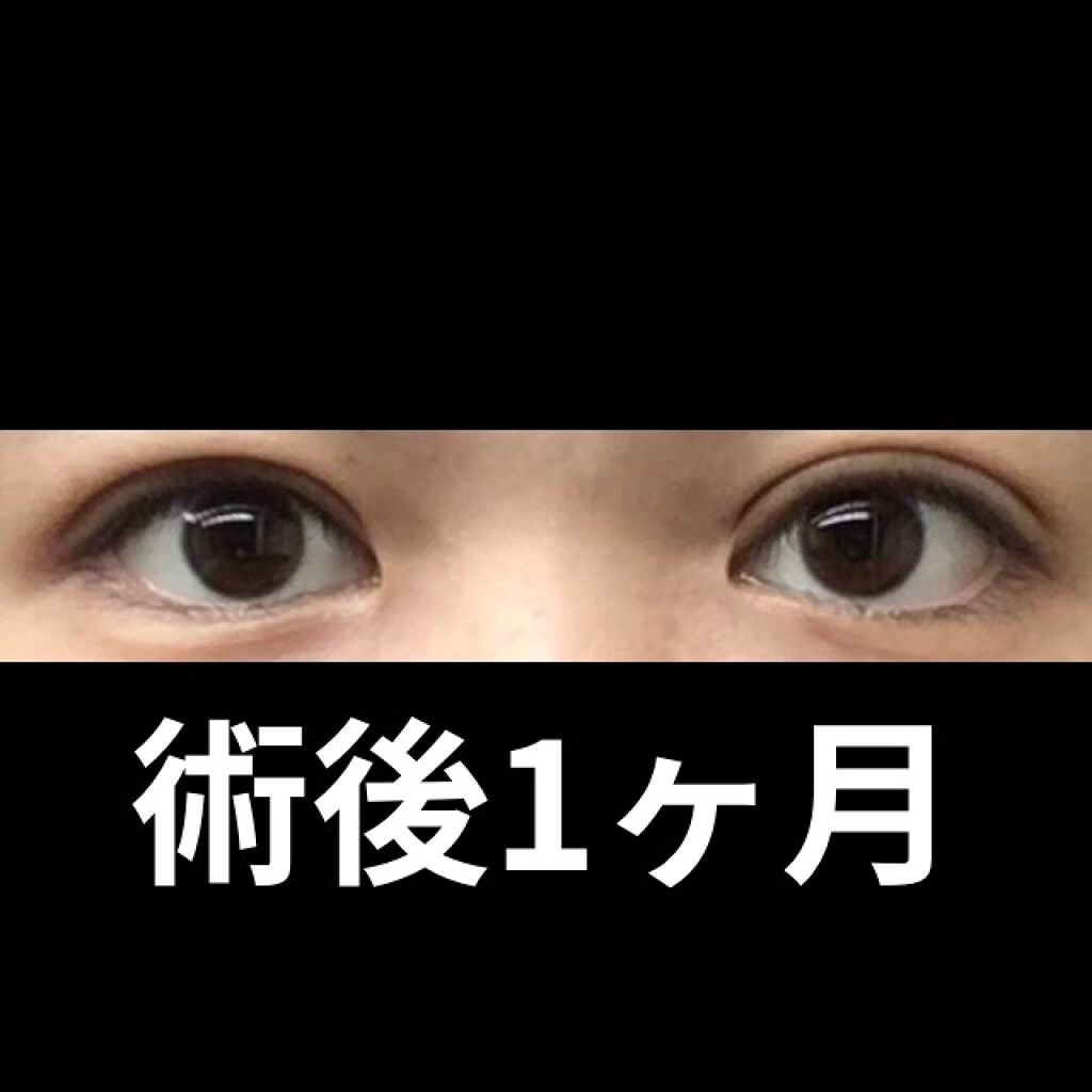 スカルプD ボーテ ピュアフリーアイラッシュセラム プレミアム/アンファー(スカルプD)/まつげ美容液を使ったクチコミ(9枚目)