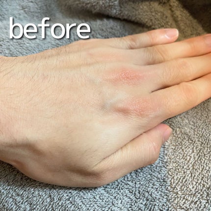 NONON/NONON(ノンノン)/除毛クリームを使ったクチコミ(4枚目)