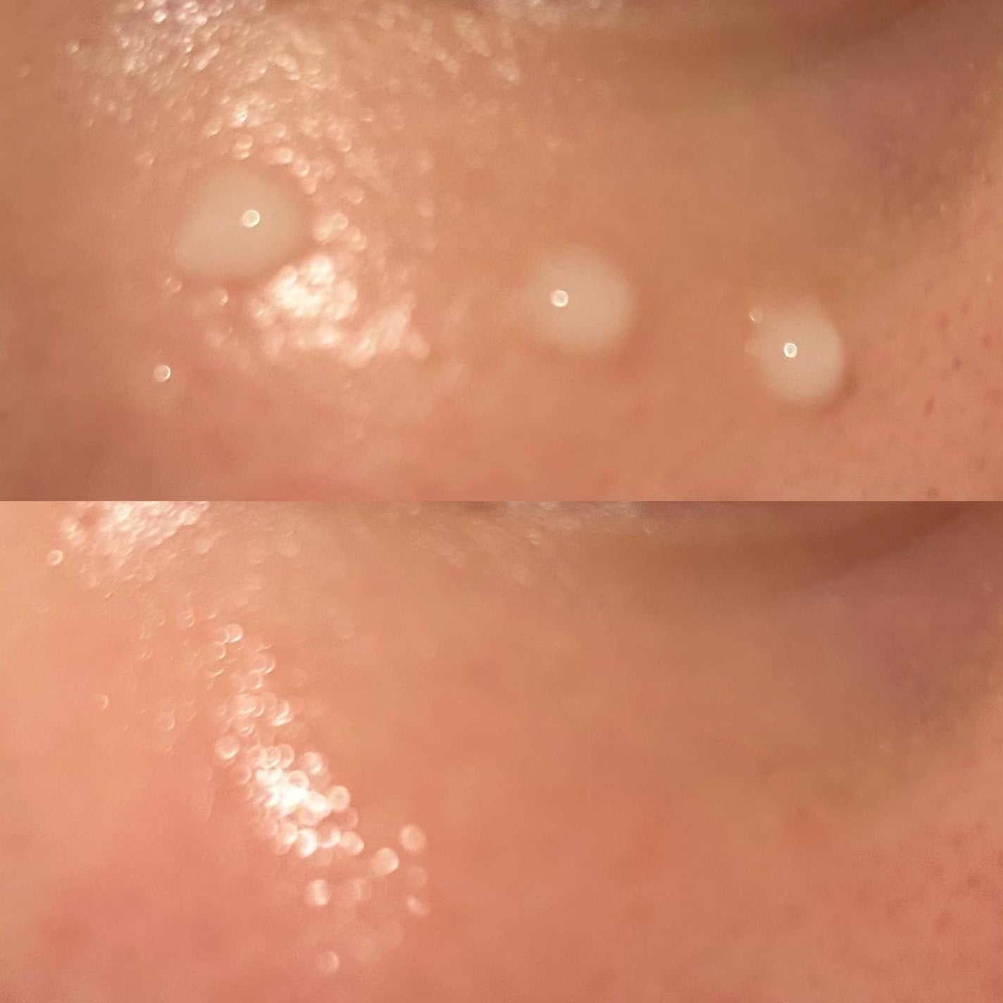 リードルショット300/VT/美容液を使ったクチコミ(5枚目)