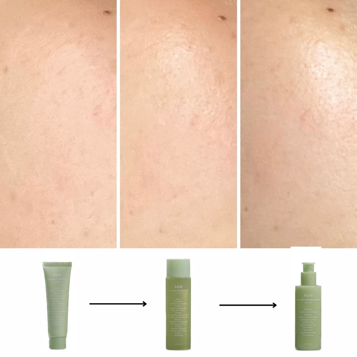 <楽天限定>ドクダミ3種セット/Abib /スキンケアキットを使ったクチコミ(5枚目)