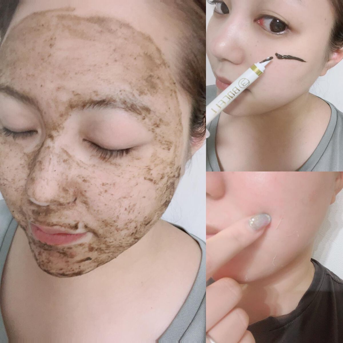 ダーマスキンピーリング/BQCELL/その他キットセットを使ったクチコミ(3枚目)