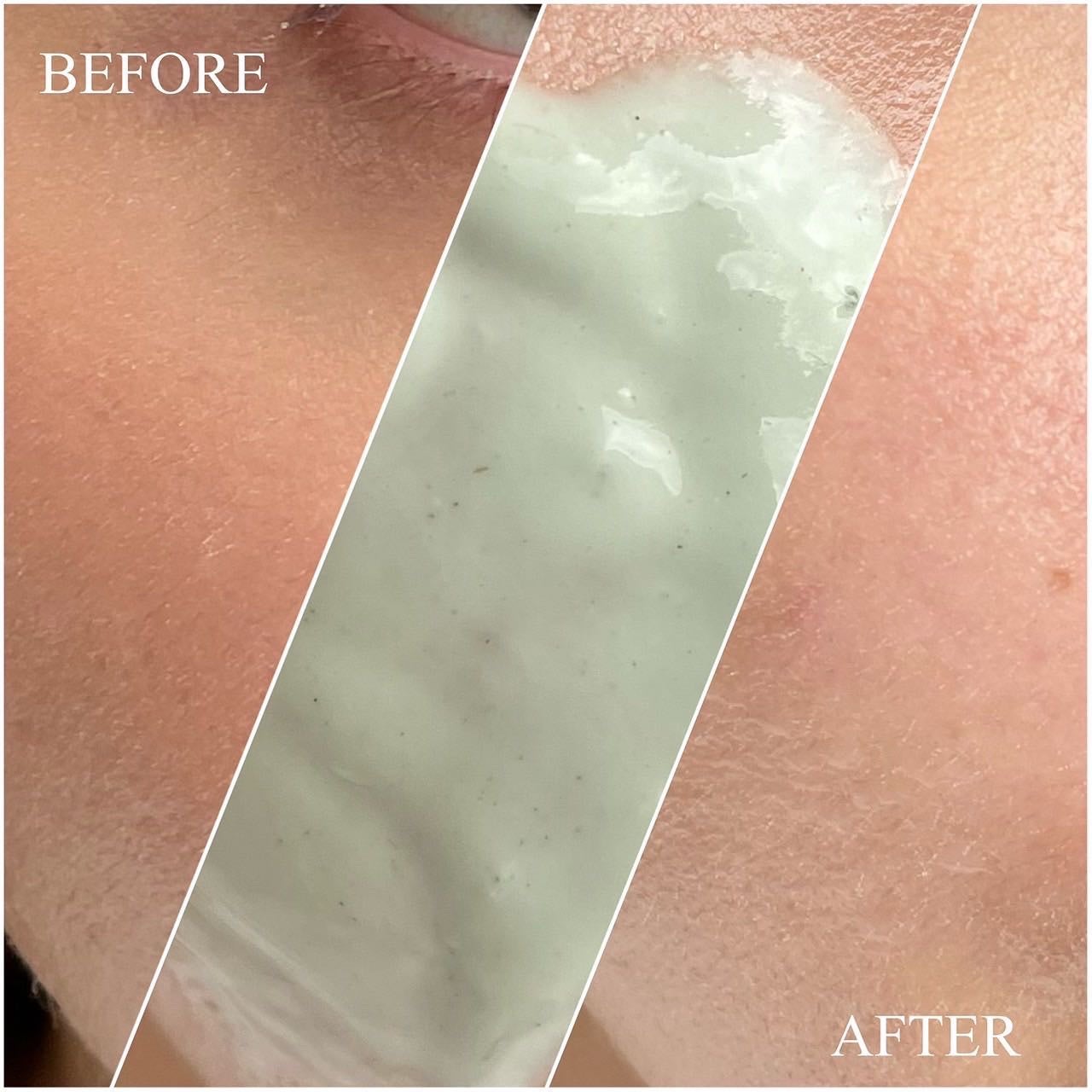 ドクダミ化粧水/ONE THING/化粧水を使ったクチコミ(6枚目)