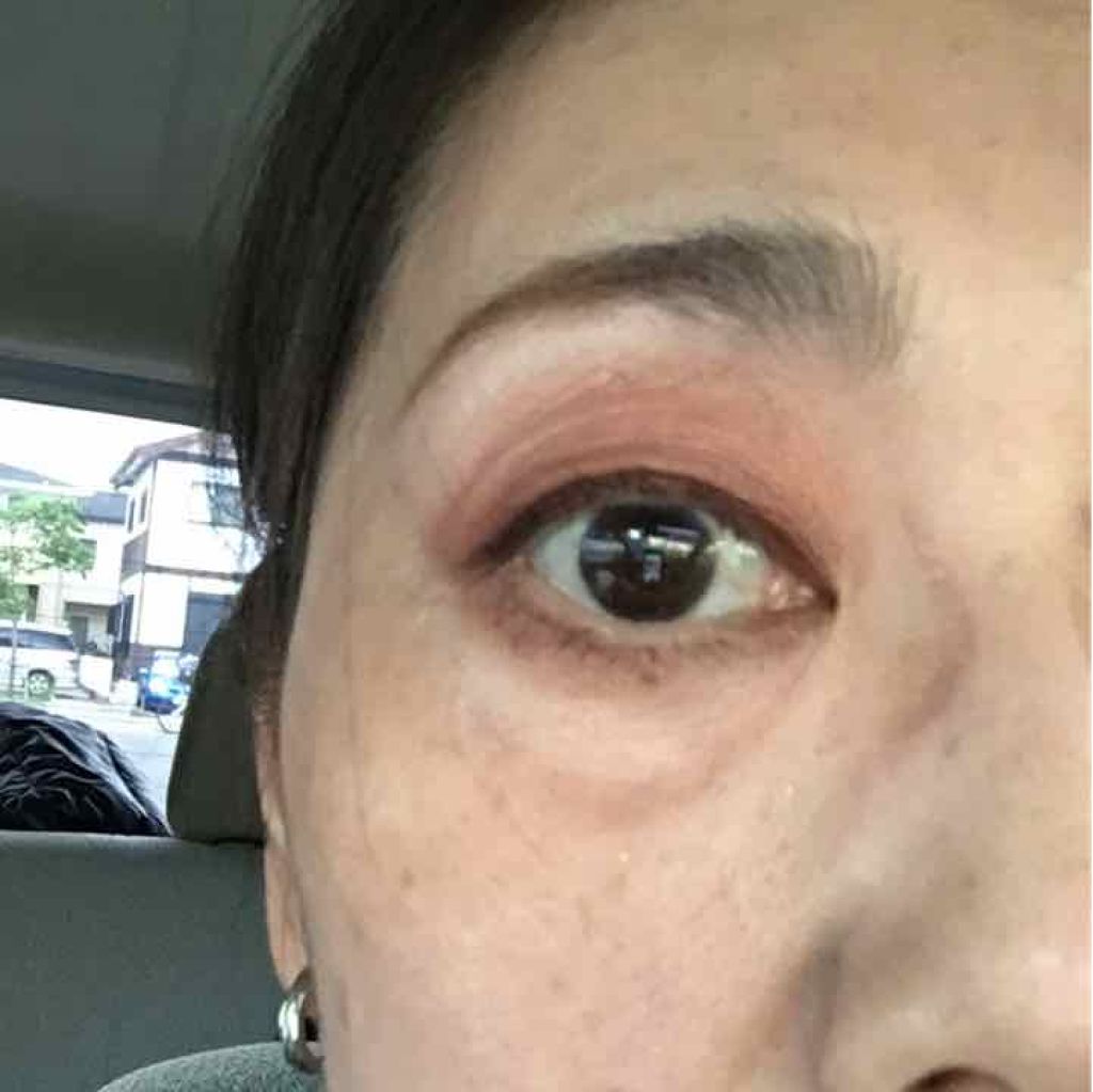 シークレットリッププランパー/himitu 秘蜜/リッププランパーを使ったクチコミ(1枚目)