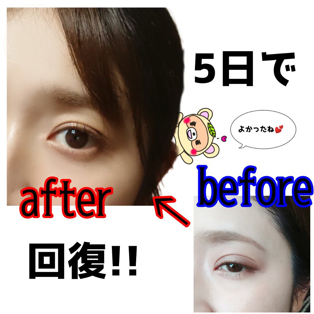 薬用ローション(とてもしっとり)/IHADA/化粧水を使ったクチコミ(6枚目)