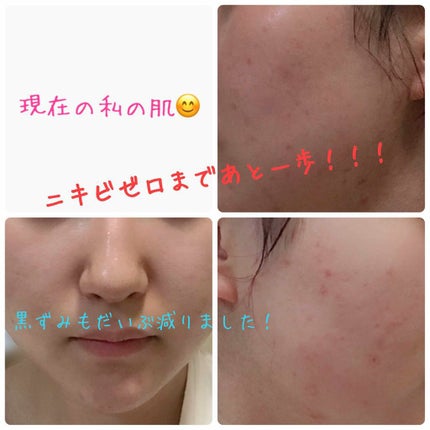 アルビオン 薬用スキンコンディショナー エッセンシャル/ALBION/化粧水を使ったクチコミ(3枚目)