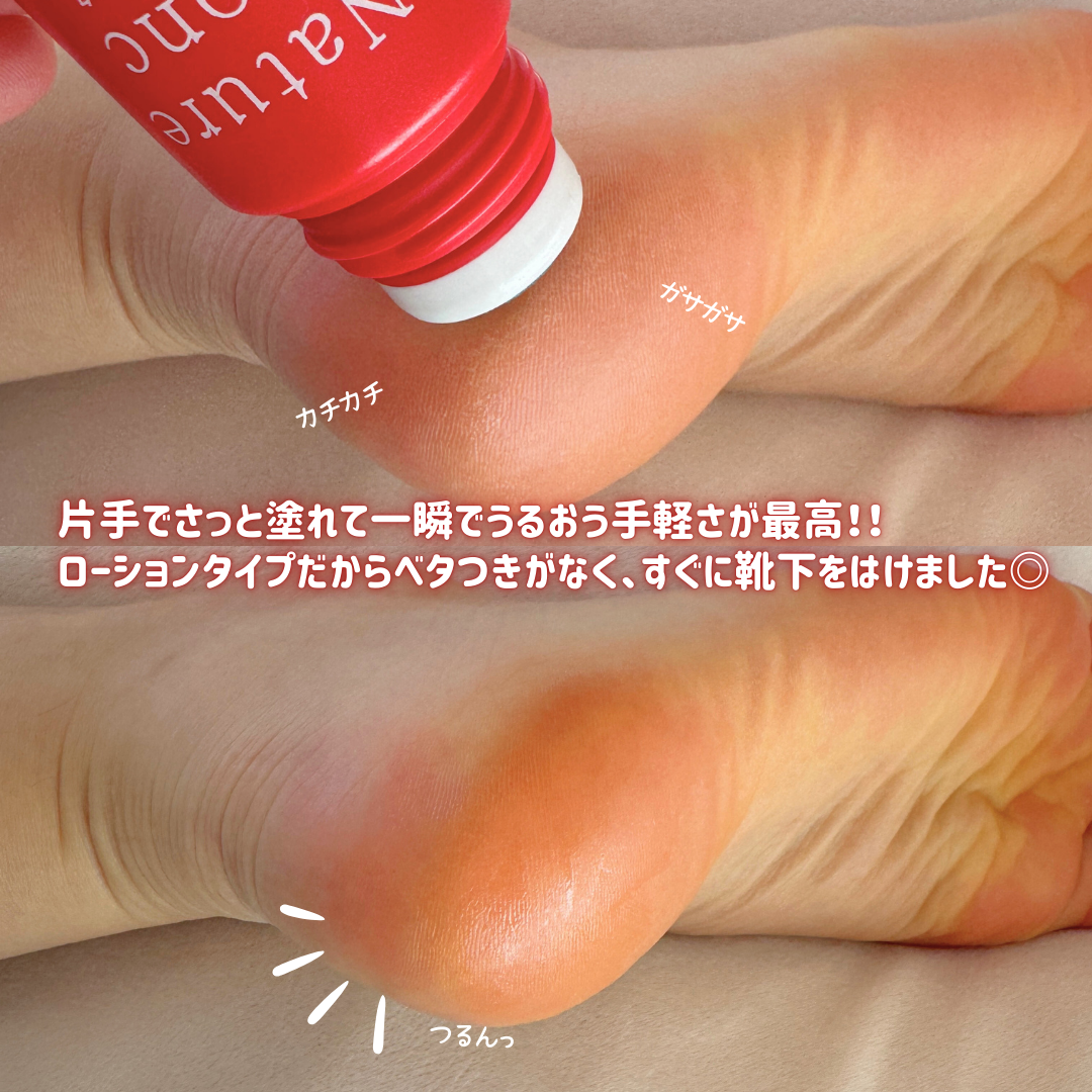 ネイチャーコンク薬用フットケアローション/ネイチャーコンク/レッグ・フットケアを使ったクチコミ（3枚目）