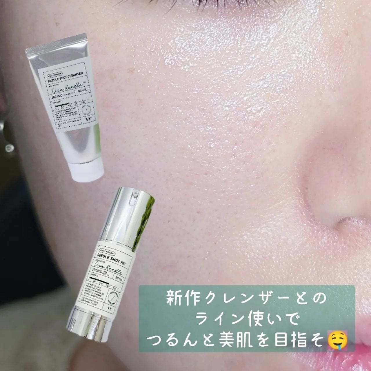 リードルショット300/VT/美容液を使ったクチコミ(7枚目)
