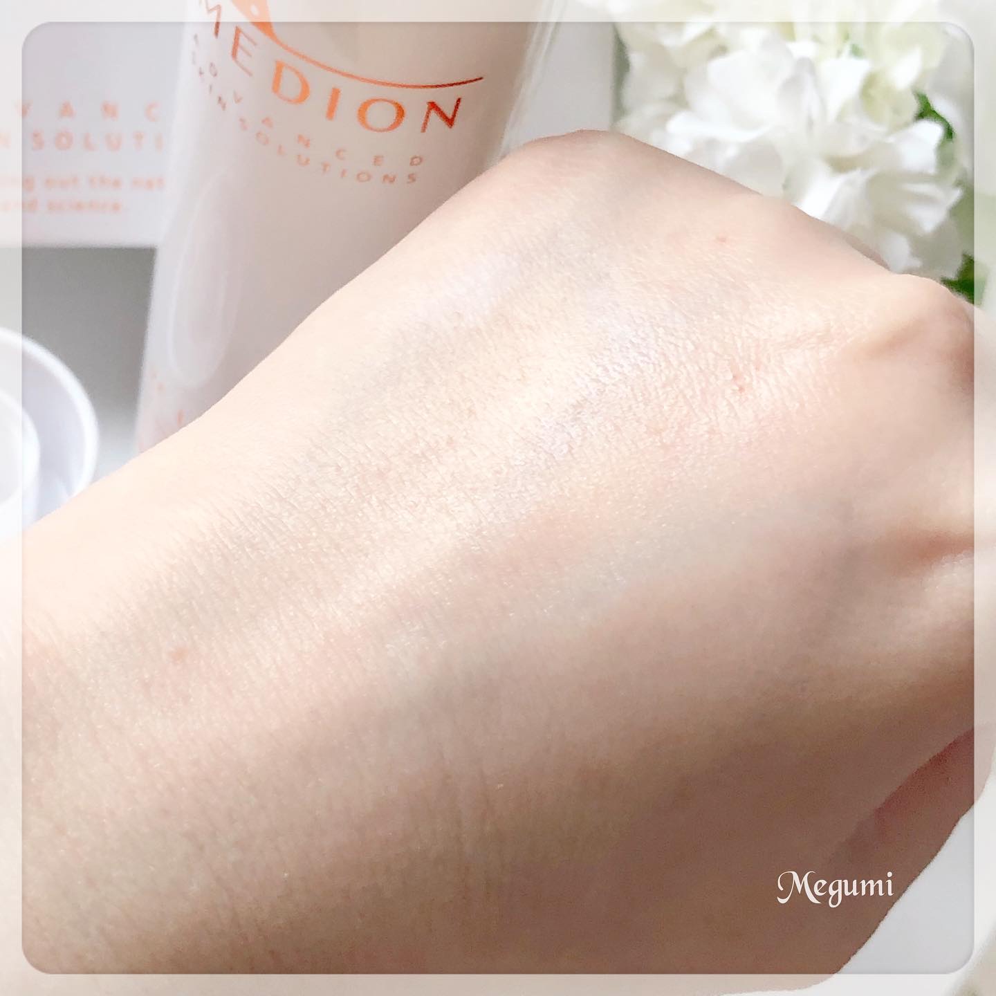 ドクターメディオン VCローションプラス/ドクターメディオン/化粧水を使ったクチコミ（3枚目）