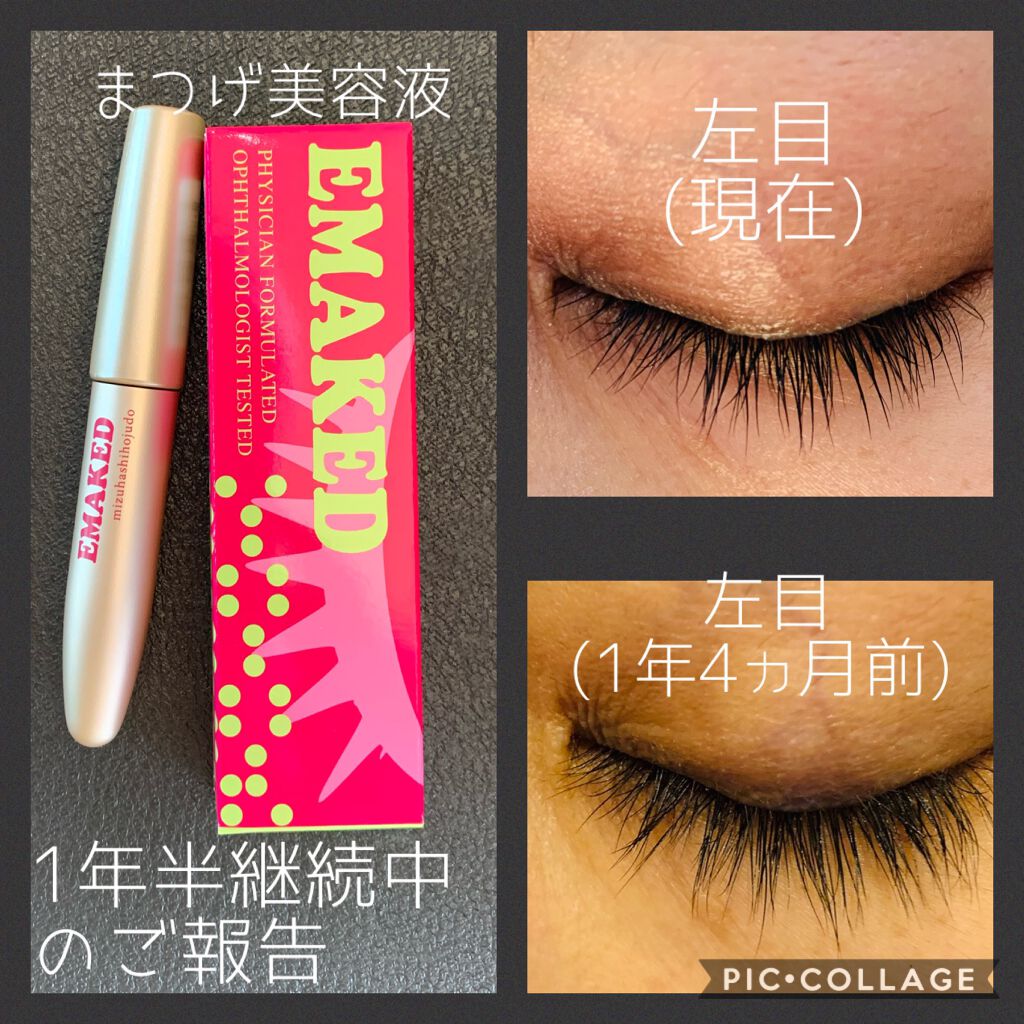 エマーキット 2ml EMAKED