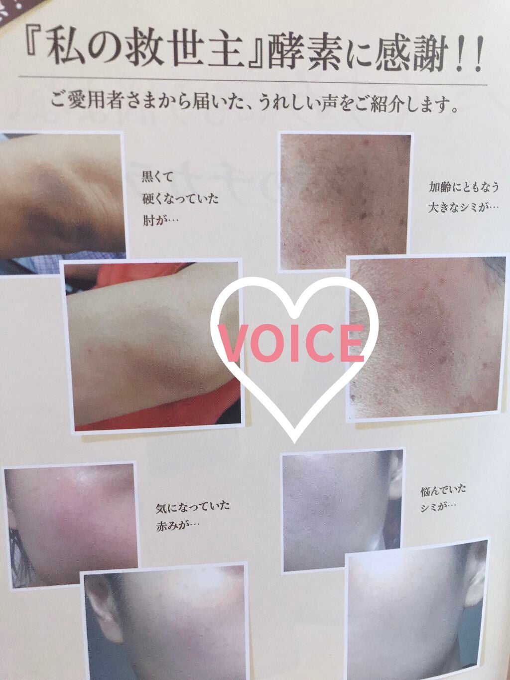 natsuki on LIPS 「こんばんは🌟寝てる人もいるかな?🛌macoさんからリクエスト頂..」(2枚目)