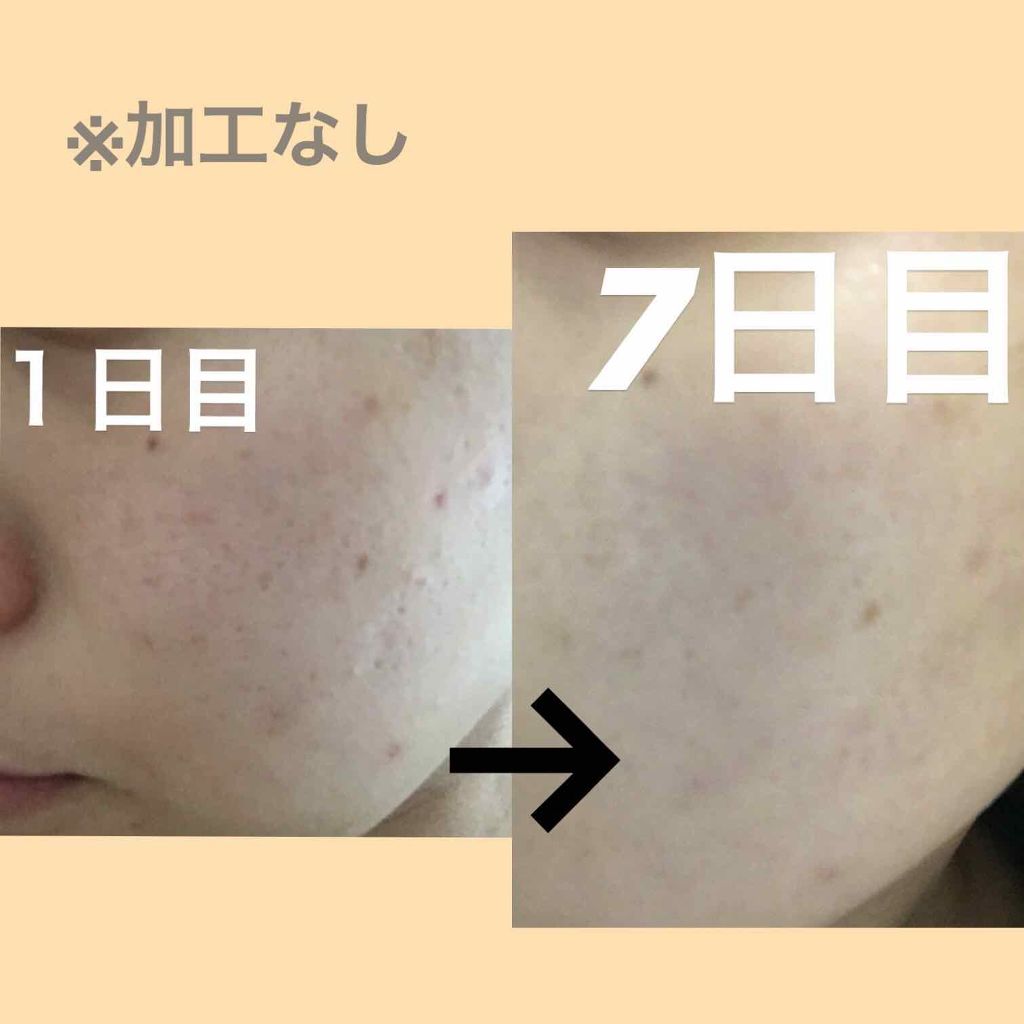 ハトムギ化粧水(ナチュリエ スキンコンディショナー R )/ナチュリエ/化粧水を使ったクチコミ(2枚目)