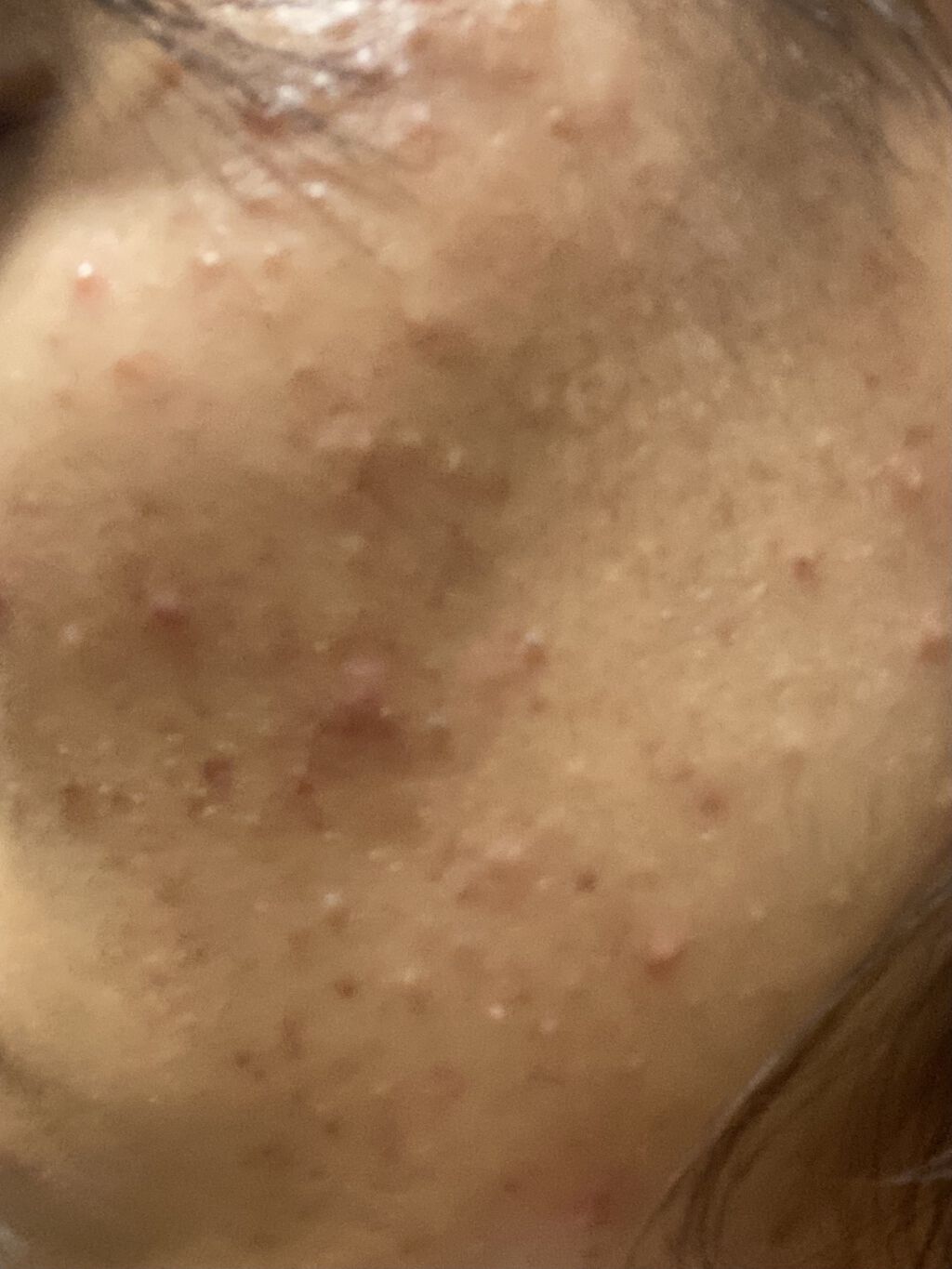 スチーマー ナノケア EH-SA35/Panasonic/美顔器・マッサージを使ったクチコミ（1枚目）