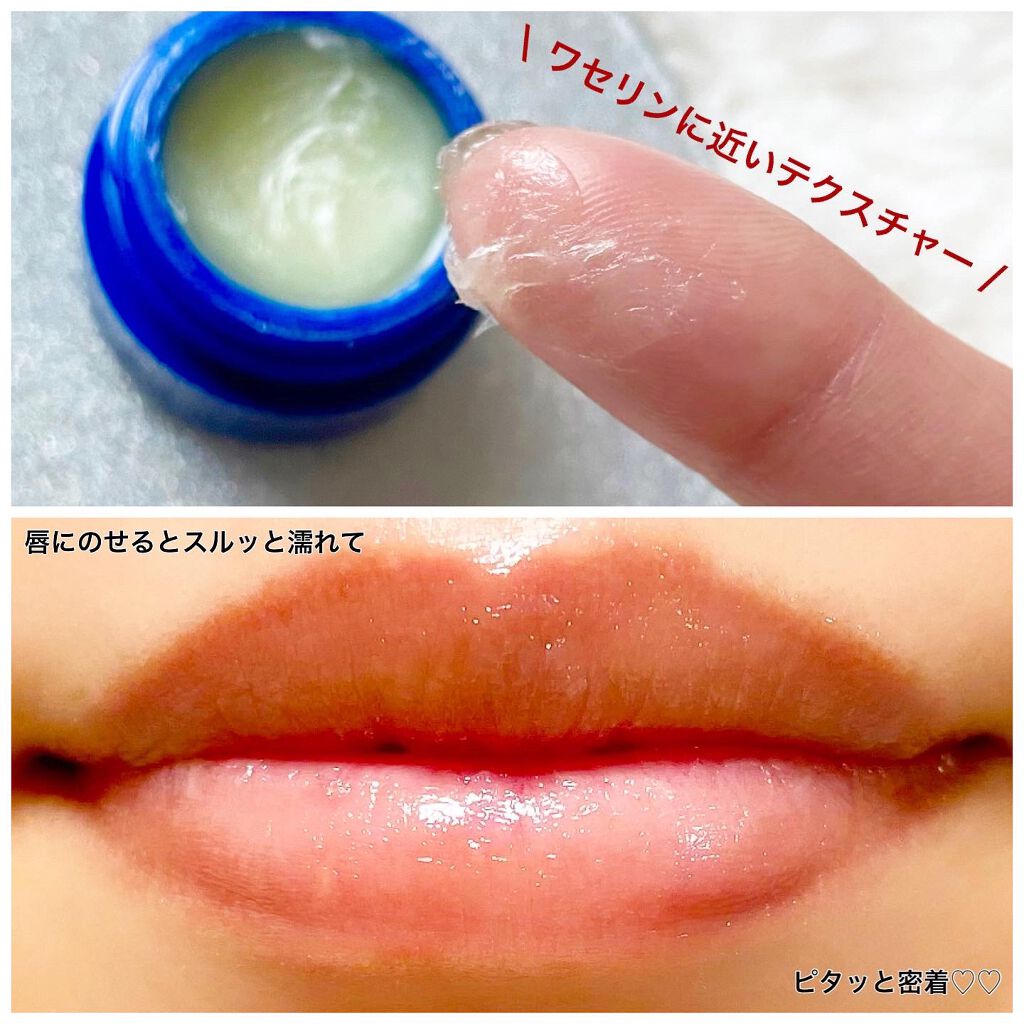 Lip Medex/Blistex/リップバームを使ったクチコミ（3枚目）