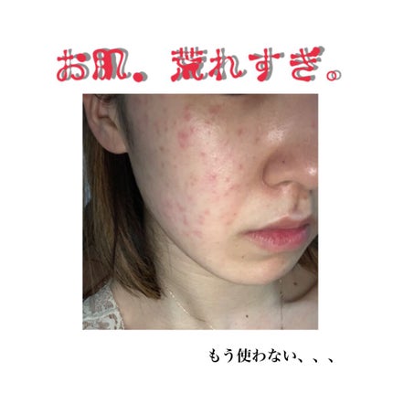 M クッション ファンデーション(モイスチャー)/MISSHA/クッションファンデーションを使ったクチコミ(2枚目)