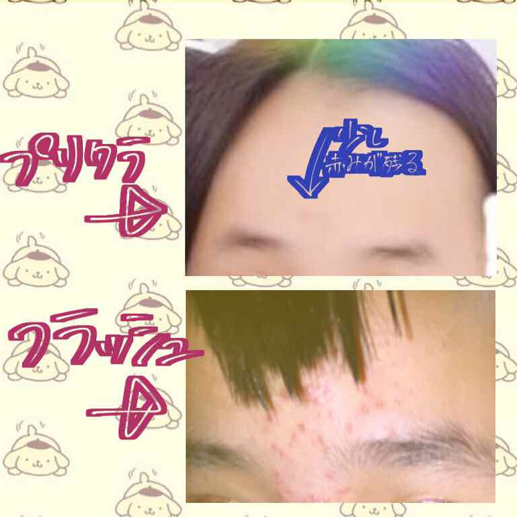 みう on LIPS 「初投稿です。こんにちは!みうです!私は小学六年生の終わり頃から..」(4枚目)