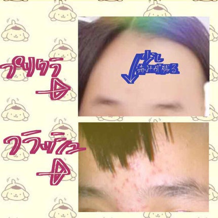 みう on LIPS 「初投稿です。こんにちは!みうです!私は小学六年生の終わり頃から..」(4枚目)