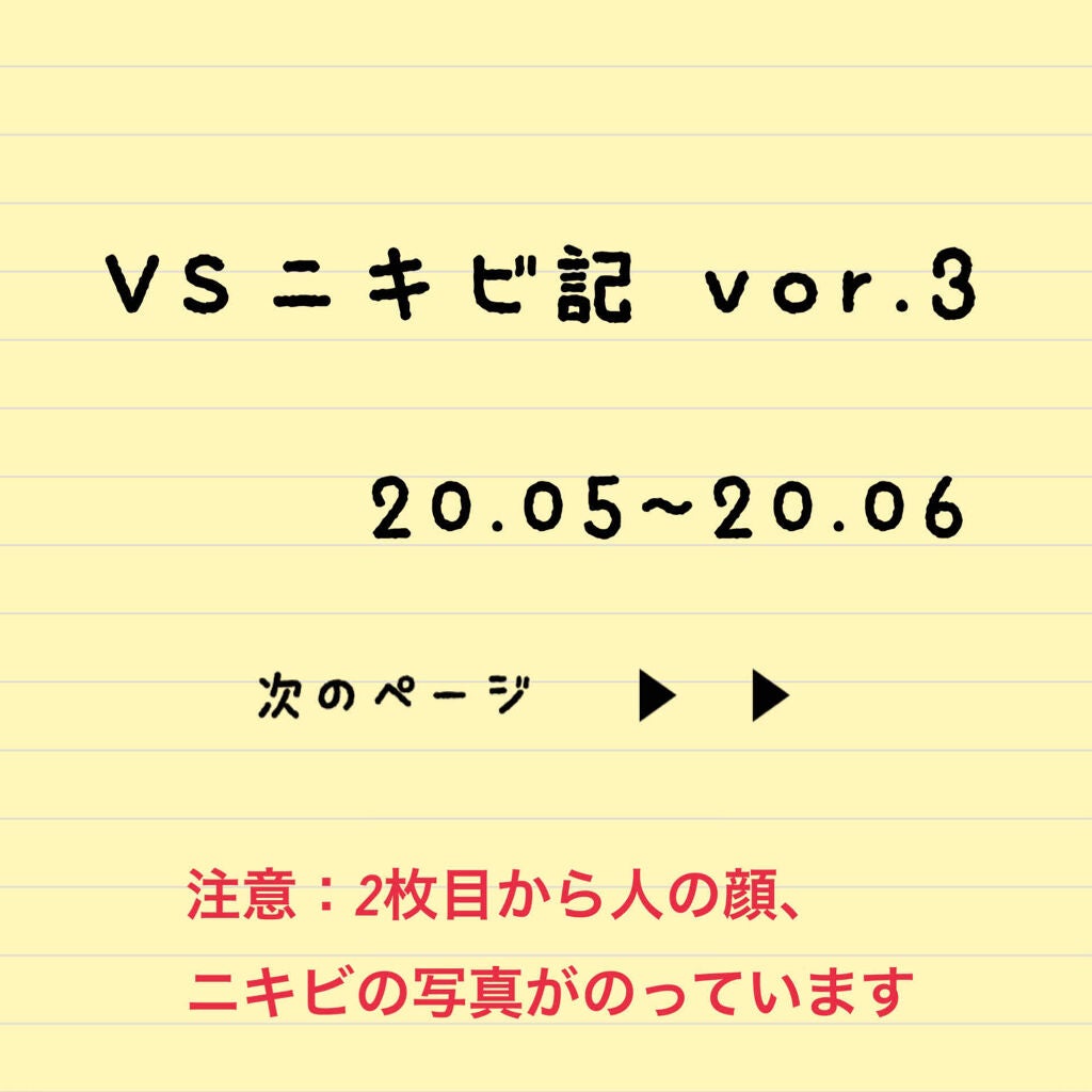 クリアターン ベイビッシュ うるおいマスク/クリアターン/シートマスク・パックを使ったクチコミ(1枚目)