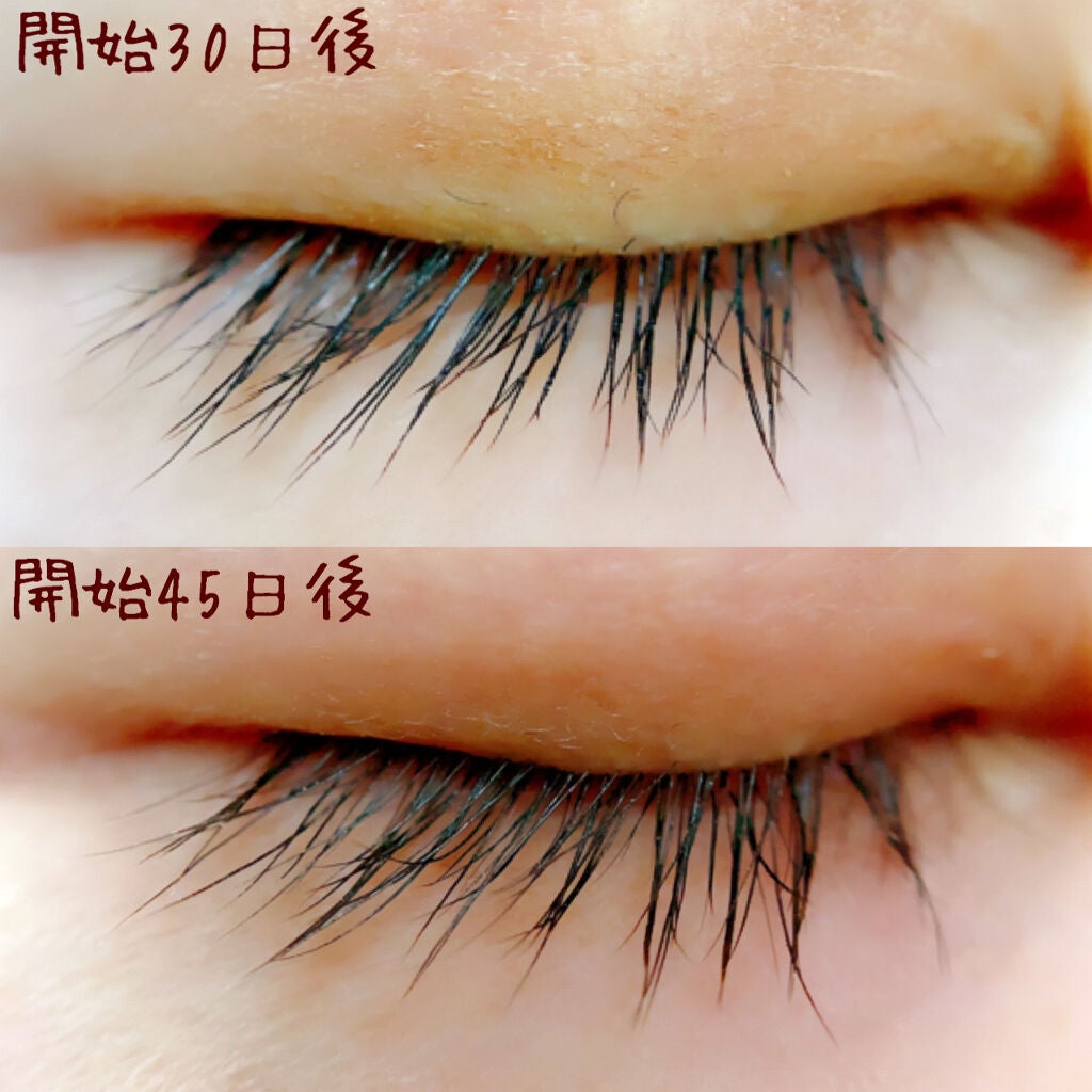 リバイタラッシュ アドバンス ジャパン/エム・アール・アイ/まつげ美容液を使ったクチコミ(3枚目)