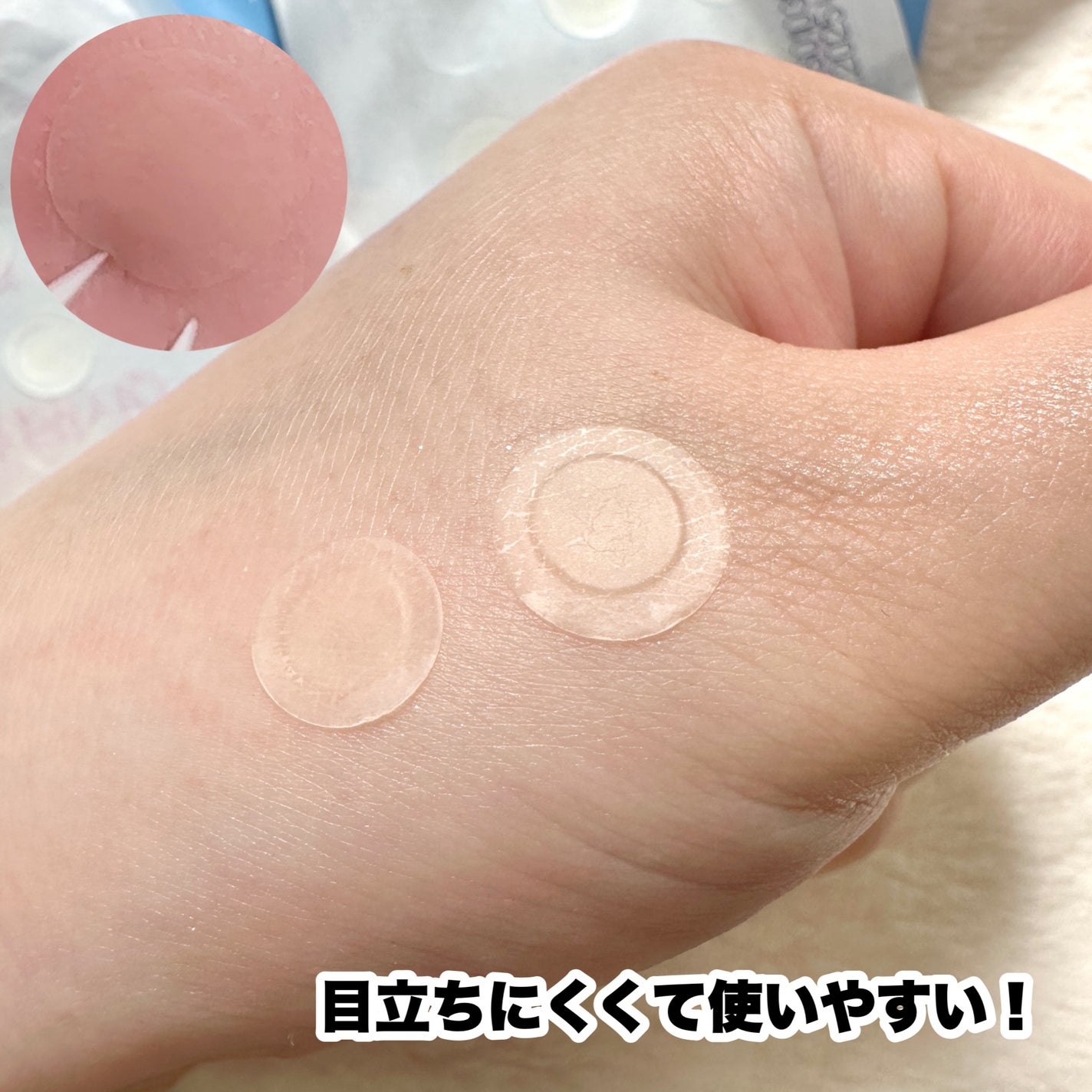 ビューティー スポットパッチ/イージーダムビューティー/にきびパッチを使ったクチコミ(4枚目)