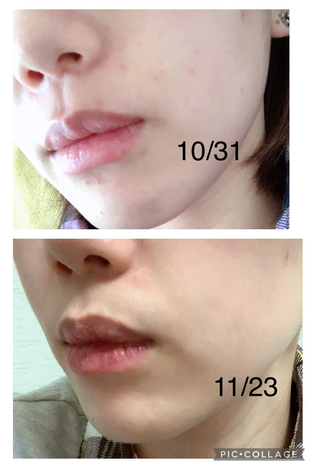 コンブチャギョルバイオムアンプル/Elishacoy/美容液を使ったクチコミ(3枚目)