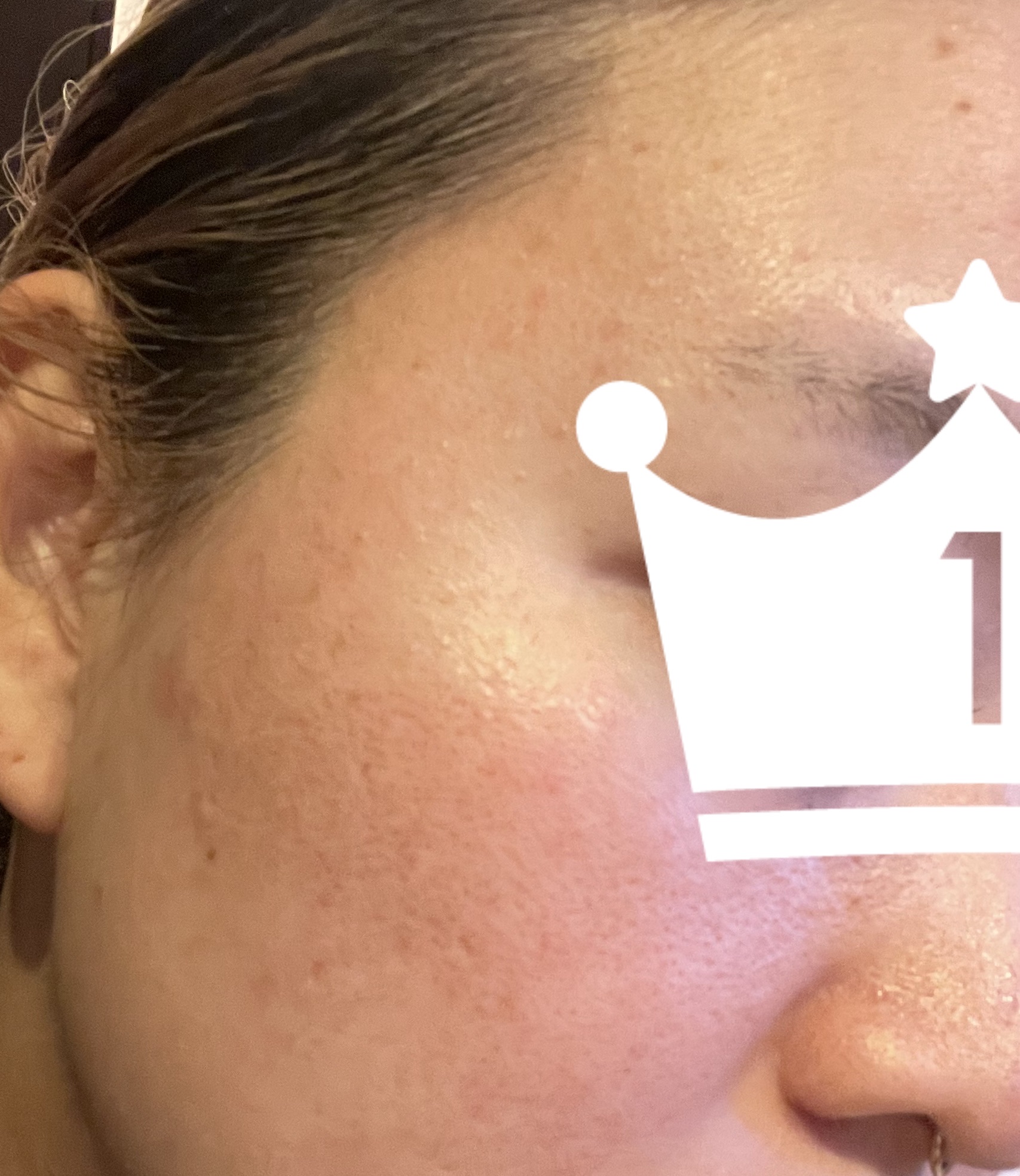 イドラクラリティ　薬用 トリートメント エッセンス ウォーター/DECORTÉ/化粧水を使ったクチコミ（3枚目）