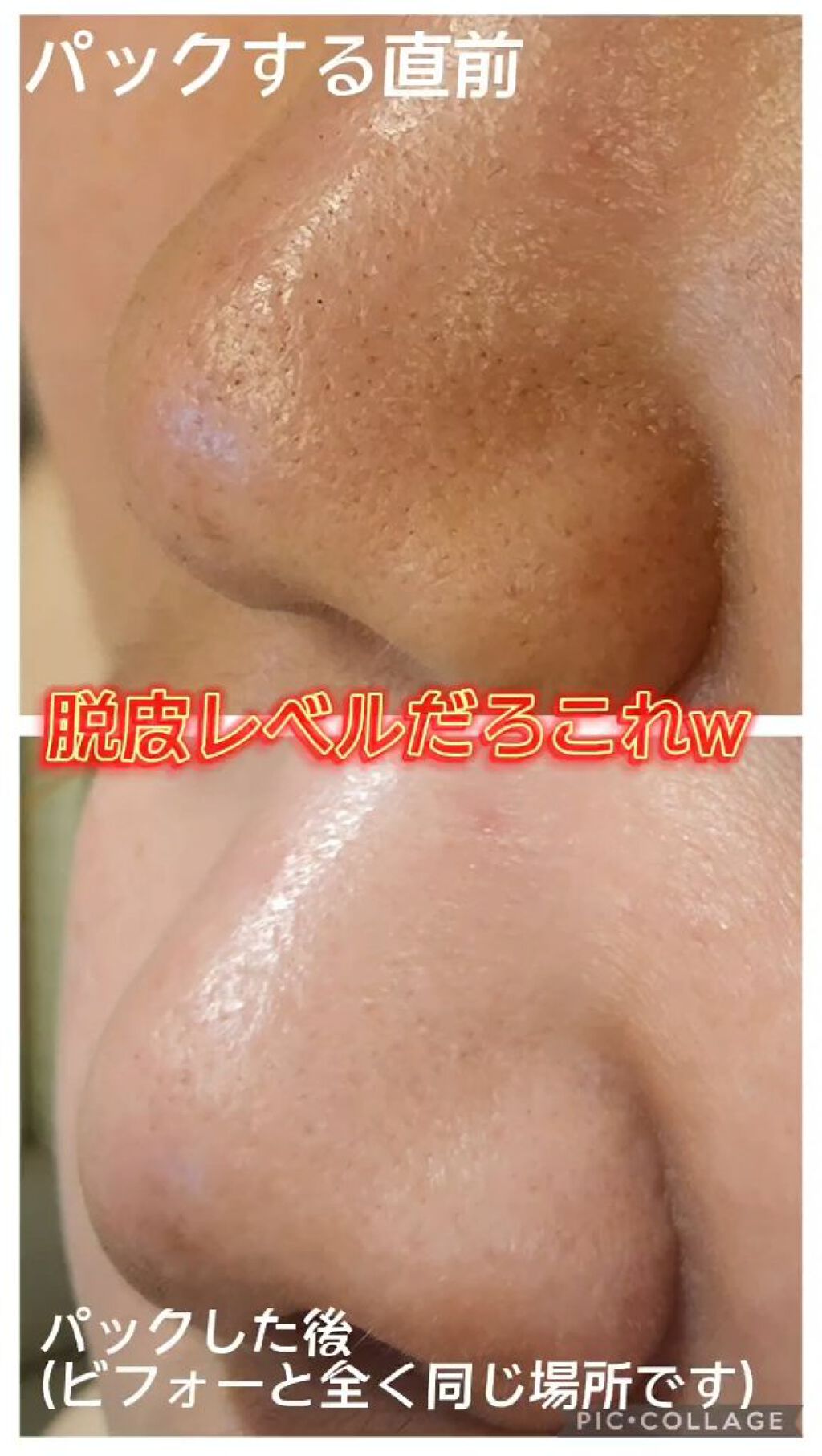 パワーマスク/ラッシュ/洗い流すパック・マスクを使ったクチコミ（3枚目）