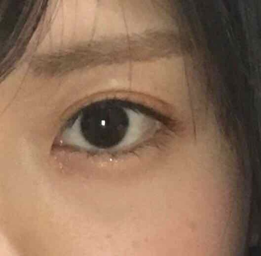 【旧品】オリシキ アイリッドスキンフィルム/D-UP/二重まぶた用アイテムを使ったクチコミ(1枚目)