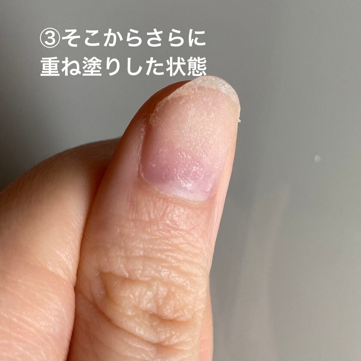 爪の補修剤 THR-01/ビー・エヌ/ネイル用品を使ったクチコミ(5枚目)