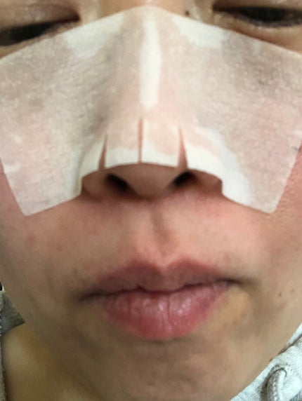 BHクリアノーズパック/CucuporeC/シートマスク・パックを使ったクチコミ(4枚目)