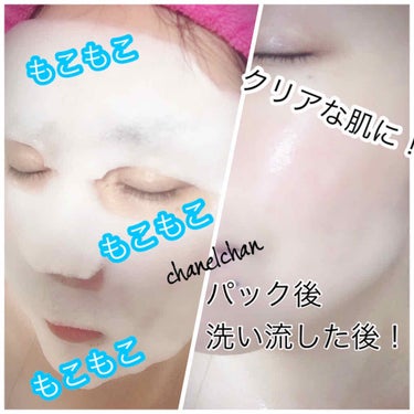 OMG! Love Gift Set (Red Bubble Mask )/double dare/シートマスク・パックを使ったクチコミ（4枚目）