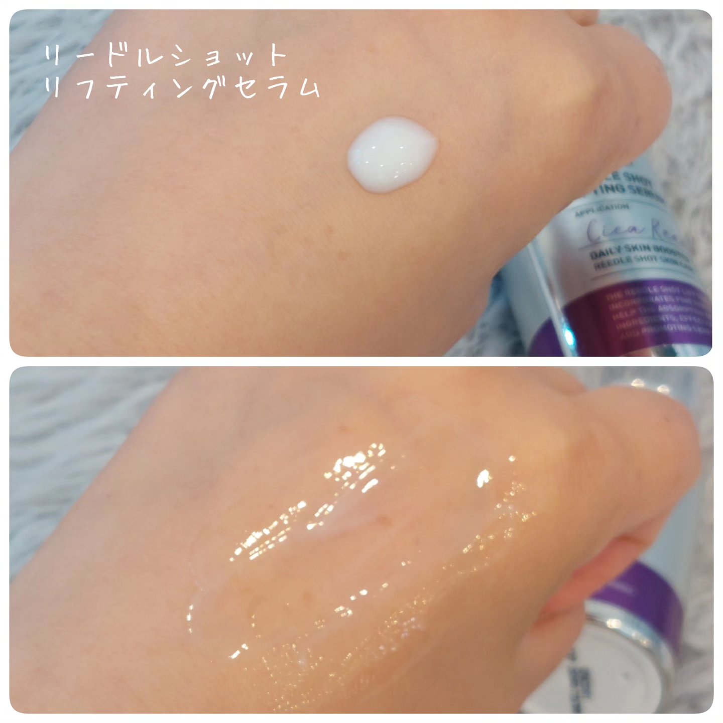 リードルショット300/VT/美容液を使ったクチコミ（3枚目）