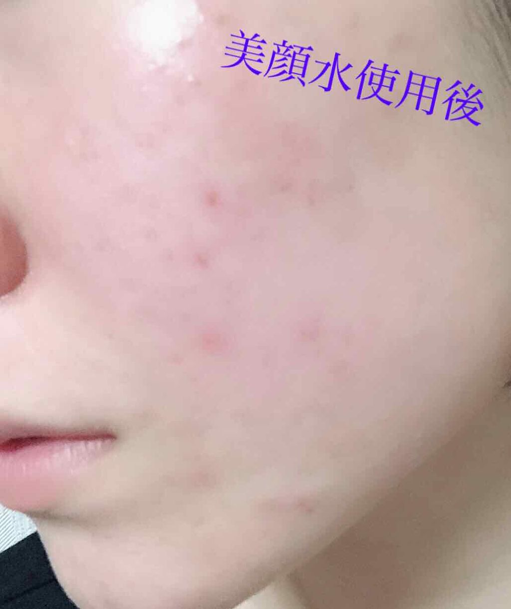 明色美顔水 薬用化粧水/美顔/化粧水を使ったクチコミ(3枚目)
