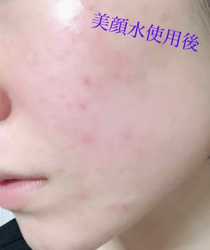 明色美顔水 薬用化粧水/美顔/化粧水を使ったクチコミ(3枚目)