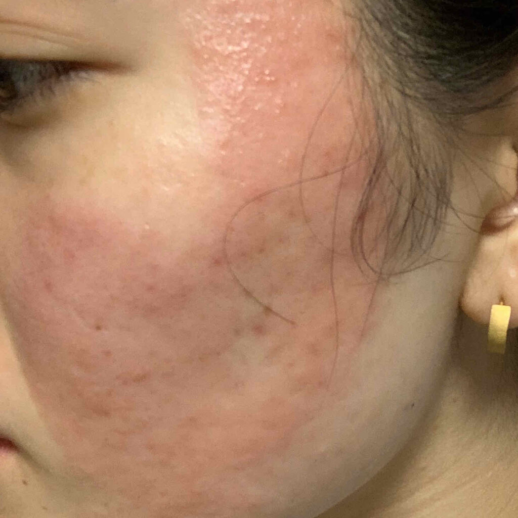 を使ったクチコミ（2枚目）