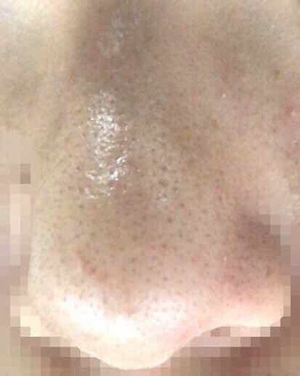 ハトムギ化粧水(ナチュリエ スキンコンディショナー R )/ナチュリエ/化粧水を使ったクチコミ(4枚目)