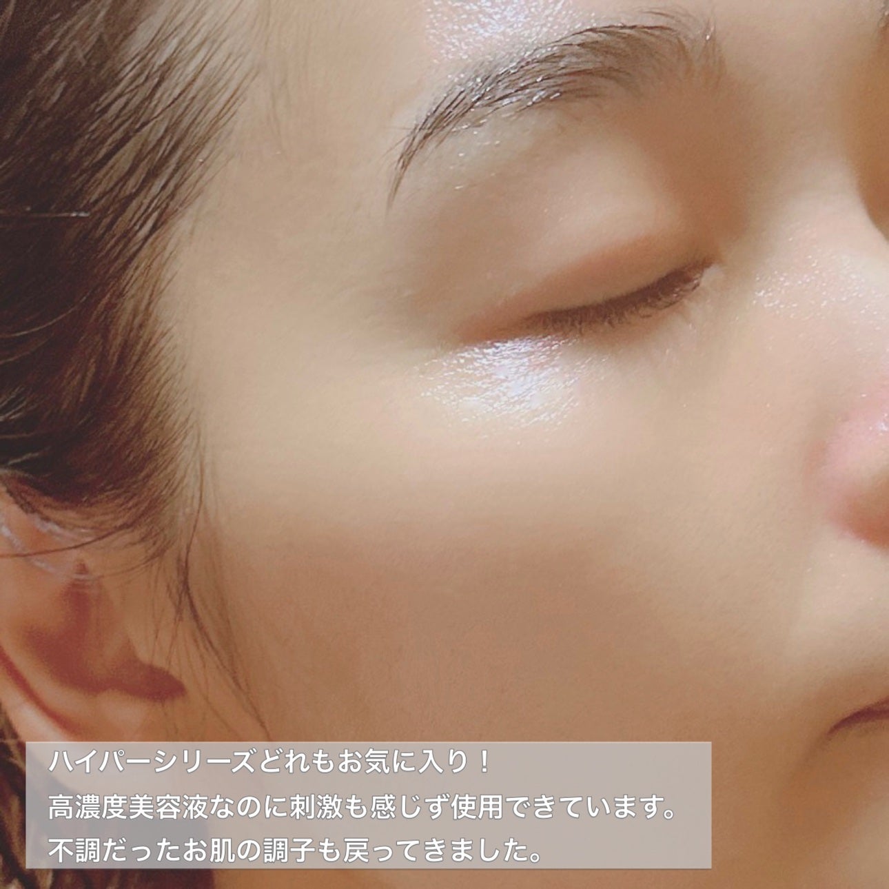 ハイパーナイアシンアミド20セラム/Isntree/美容液を使ったクチコミ(8枚目)