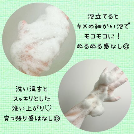 AHA·BHA·PHA 30デイズミラクルアクネボディクレンザー/SOME BY MI/ボディソープを使ったクチコミ(5枚目)