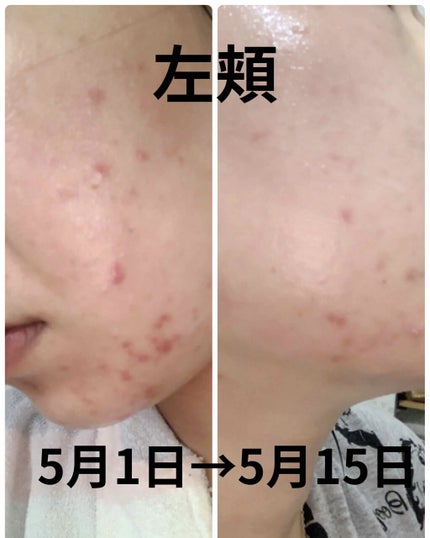 ãšããã¥ãªã²ã«/ãã«ãæ ªåŒäŒç€Ÿ/ãã®ä»ã䜿ã£ãã¯ãã³ãïŒ2æç®ïŒ