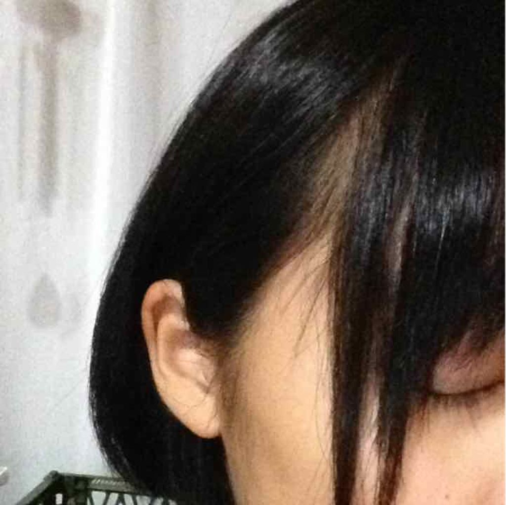 モアリップ N (医薬品)/資生堂薬品/その他を使ったクチコミ（2枚目）