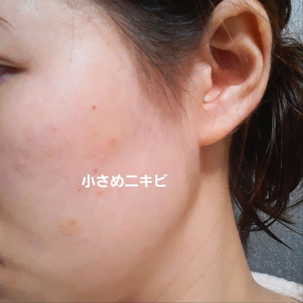 プロCICA クリアスポットパッチ/VT/その他スキンケアを使ったクチコミ(4枚目)