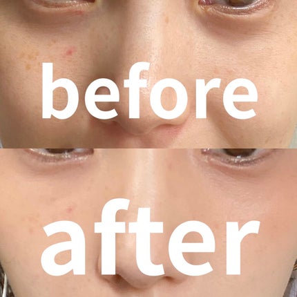 リシェ レッドトリック アイコンシーラー/Visée/パレットコンシーラーを使ったクチコミ(4枚目)