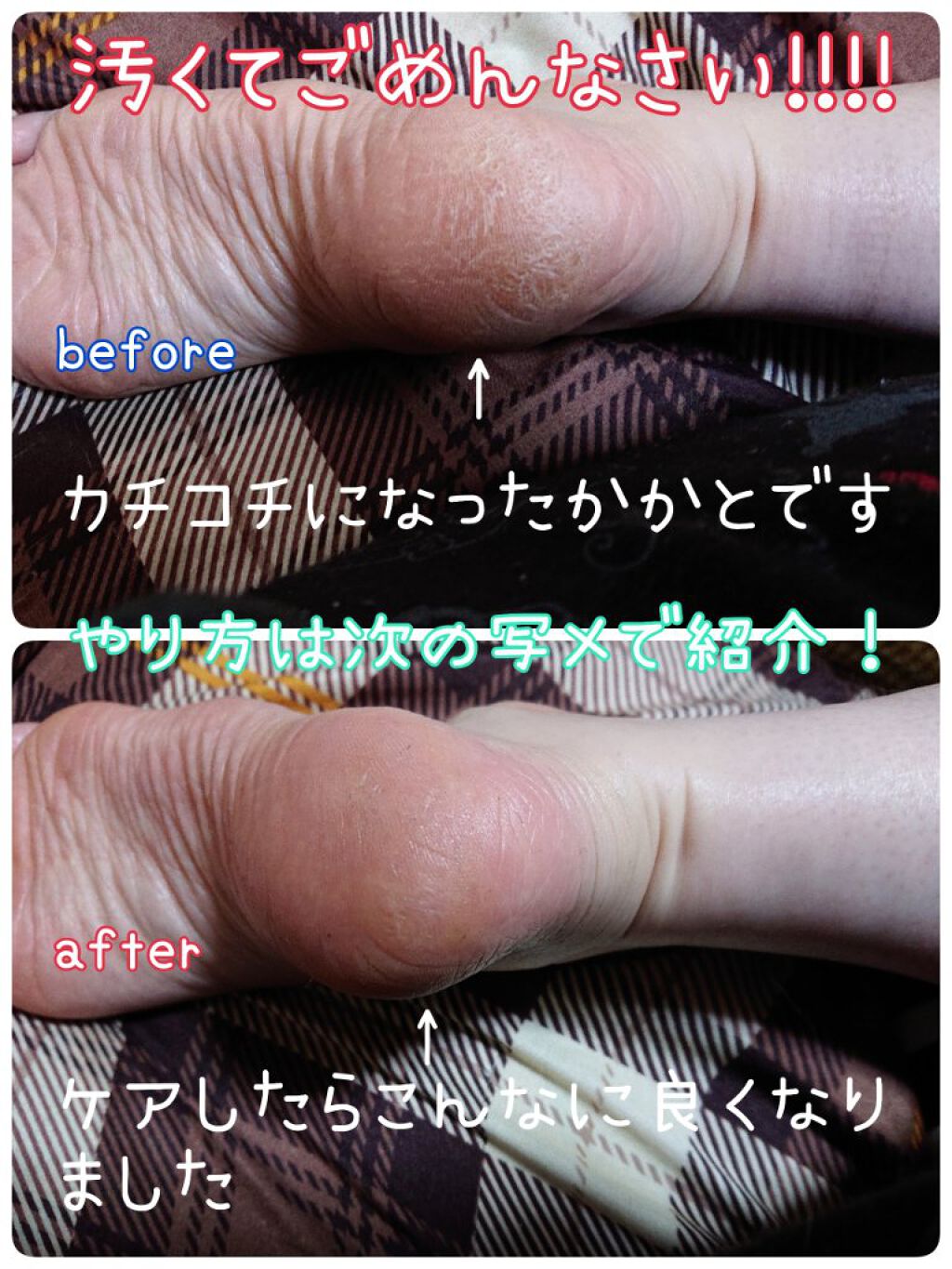 スクワラン配合オイル美容液BB/DAISO/フェイスオイルを使ったクチコミ（2枚目）