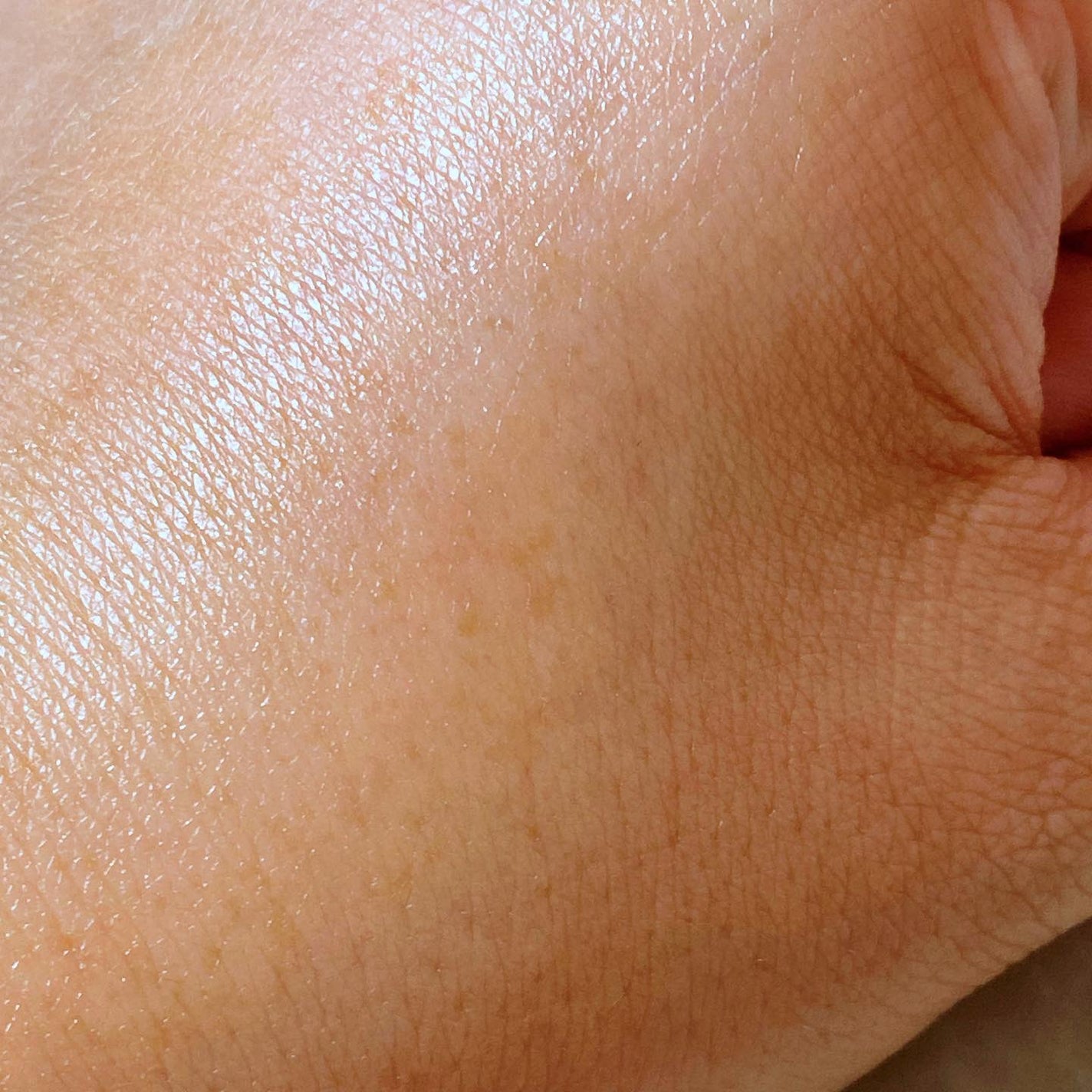 グルタシカ Mクリーム/Dr.Viuum/フェイスクリームを使ったクチコミ(4枚目)