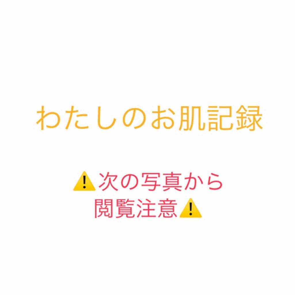 薬用しみ対策 美白化粧水/メラノCC/化粧水を使ったクチコミ（1枚目）