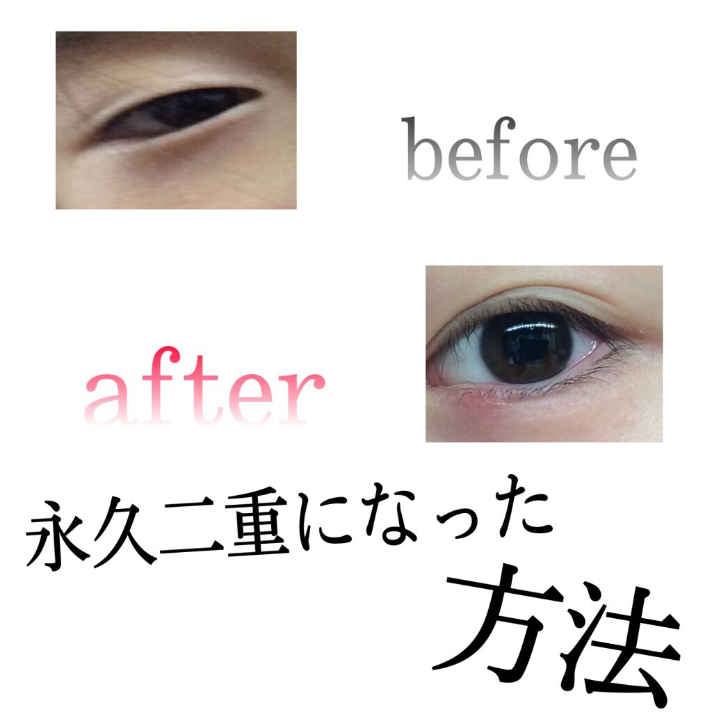 アイテープ 埋没式両面テープ/DAISO/二重まぶた用アイテムを使ったクチコミ(1枚目)