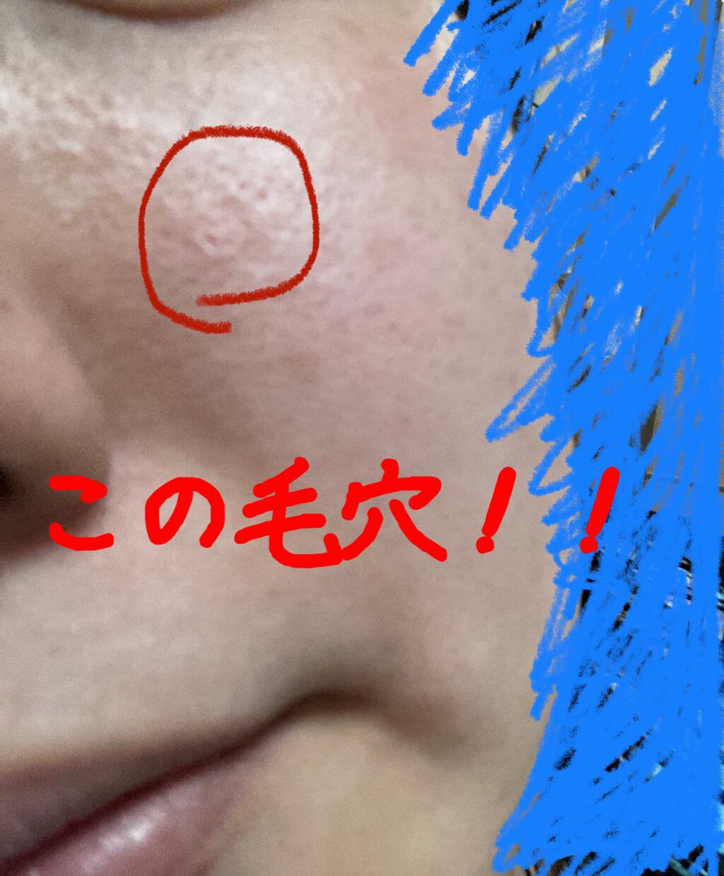 レチノールA 1% アドバンスドリバイタリゼーションクリーム/Life-flo/フェイスクリームを使ったクチコミ（3枚目）