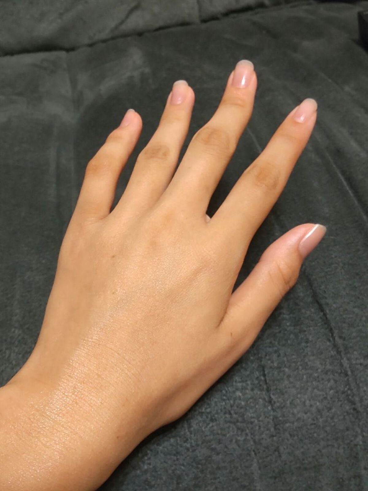 演劇系の人*フォロバします on LIPS 「現時点での手の肌はこんな感じです。ここから色々なスキンケア用品..」(1枚目)